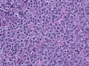 Bone Marrow Hematopoetic After RDO Decalcifier Bone Marrow Hematopoetic After RDO Decalcifier