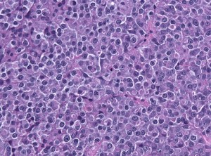 Bone Marrow Hematopoetic After RDO Decalcifier