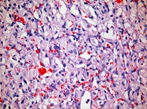 Bone Marrow Hematopoetic After RDO Decalcifier Bone Marrow Hematopoetic After RDO Decalcifier
