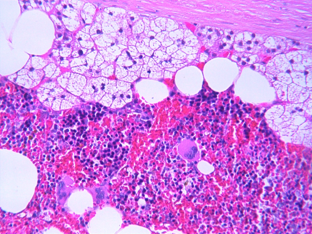 Bone Marrow Hematopoetic After RDO Decalcifier Bone Marrow Hematopoetic After RDO Decalcifier