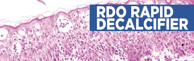 RDO Rapid Decalcifier